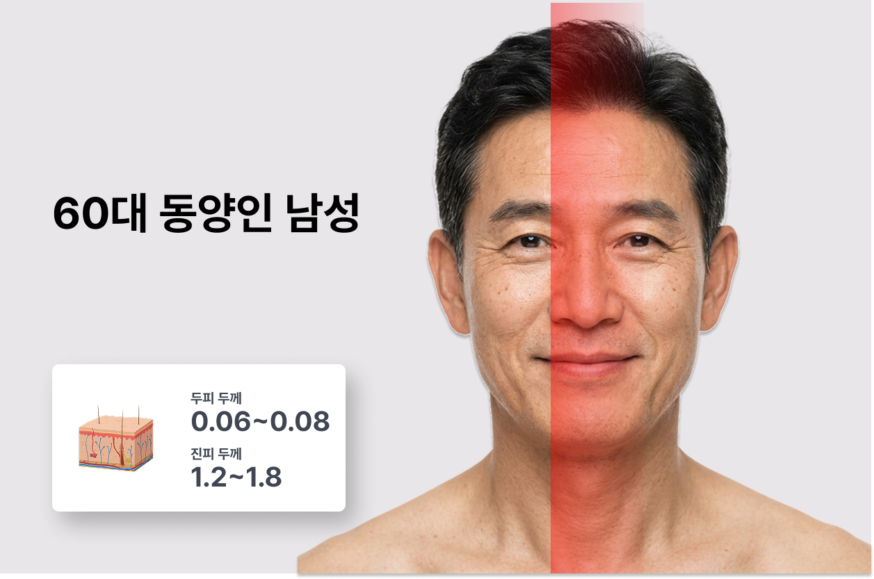 60대 동양인 남성 피부 두께